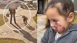 Owner Of Dog That Attacked 3 Year Old Girl In Spring Texas Restaurant Charged With Injury To Child Abc7 Los Angeles