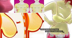 Bentuk puting payudara yang berbintik. Kenapa Waktu Remaja Payudara Elok Terletak Tapi Lepas Kahwin Bersalin Labuh Macam Buah Betik Masak Nona