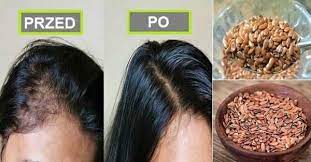 Sposob Na Piekne Wlosy Ktory Znaly Nasze Babcie Hair Vitamins Hair Remedies For Growth Flaxseed Gel