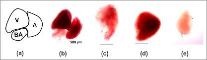The blood then gets pumped into the ventricle. Chamber Specific Gene Expression Landscape Of The Zebrafish Heart
