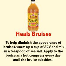 Heals Bruises Bruises Remedy Apple Cider Vinegar Detox Organic Apple Cider