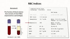 How To Interpret Rbc Indices E G Hemoglobin Vs Hematocrit Mcv Rdw Youtube