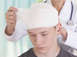 Among children, most concussions happen on how is a concussion diagnosed? Skull Fractures Types Causes And Symptoms