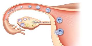 3 om fremfall og operasjonen f r e m fa l l av s k j e d e v e g g e n fremfall (prolaps) innebærer at skjedens fremre eller bakre vegg buker ned i skjeden eller ut av skjedeinngangen. Underlivsprolaps Lommelegen