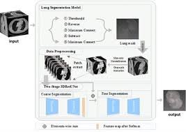 Anna ong is on facebook. Frontiers Anterior Mediastinal Lesion Segmentation Based On Two Stage 3d Resunet With Attention Gates And Lung Segmentation Oncology