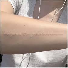 Literally Just 650 Seriously Cool Ideas For Your Next Tattoo White Tattoo Harry Potter Tattoos Ink Tattoo