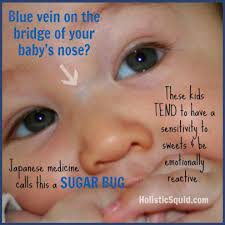 Is Your Baby S Blue Vein A Sugar Bug Holistic Squid Baby Health Baby Kids Health