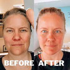 James Swanwick - This is the before and after of one of... | Facebook