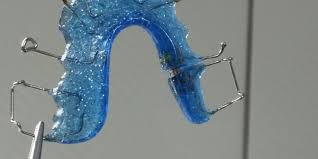 Your orthodontic doctor will determine the best retainer to use on your teeth. You Ll Freak When You Discover All The Bacteria In Your Dental Retainer