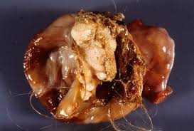Feb 11, 2020 · @alwaysclau: The Monster Tumor Pathology Student