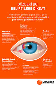 Gozdeki Bu 6 Belirtiye Dikkat Dunyagoz Hastanesi