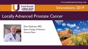 Although screenings for prostate cancer are one tool for early detecti. Locally Advanced Prostate Cancer Dov Kadmon Video