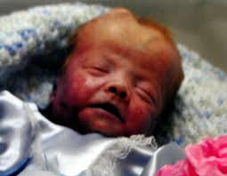 Austin Eicher Obituary