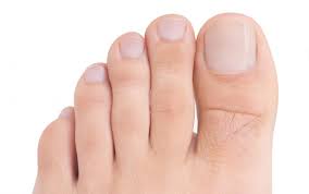 Problemas Mas Comunes En Las Unas De Los Pies Causas Y Tratamientos Podoactiva Lideres En Podologia