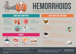 Hemorrhoids Can Become A Serious Health Issue If We Do Not Pay Attention To Our Diet And Bowel Habits Hemorrhoids Treatment Hemorrhoids Cure For Hemorrhoids