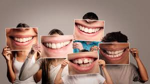 When Baby Teeth Turn Grey Forest Lawn Dental Centre