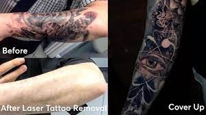 The global tattoo removal market was valued at $11,614 million in 2016, and is projected to reach at $27,317 million by 2023, growing at a cagr of 12.7% from 2017 to 2023. Pulse Light Clinic S Innovative Laser Tattoo Removal Technol Menafn Com