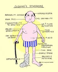Nursing Nclex Help Cushing S Disease Teach Diet Should Be Low Carbohydrate Nursing School Survival Nursing School Notes Nurse