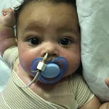 It is even more difficult if he is your first baby. The Sitter Said The Baby Was Burned In The Bath But That Doesn T Explain His Wounds Viralnova