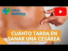59 Ideas De Liss En 2021 Como Amarte A Ti Mismo Despues De Una Cesarea Magnesio En El Cuerpo