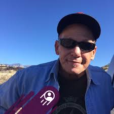 People Can't Believe How This Woman Looks After Getting A $11k Nose Job