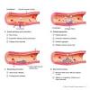 Aeroembolism, air embolism, bends, caisson disease, decompression sickness, gas embolism. Https Encrypted Tbn0 Gstatic Com Images Q Tbn And9gcr1jxx3fwmg5jpnv1wwggas4yfwllcwtbcymvbbhbb9ddlvyghw Usqp Cau