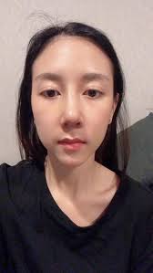 ⚡️The “before & after” pictures keep rolling in!! The results are amazing &  beautiful! You cannot lose with NeoFiller!! 🥰💃🏻💃🏻 ⚡️If you're using  it… remember: Expectations are for 90 days! 100% of