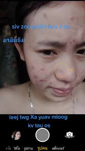 ມາມີ່ຄຮີມຕ້ອງການຖາມໄດ້ເດີ #ໃຊ້ແລ້ວດີມາກ #ໃຜຢາກໄດ້ທັກມາໄດ້ເດີພ້ອມສົ່ງ ...