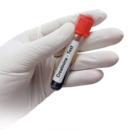 CREATININE product image