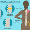 The trapezius is a broad, flat and triangular muscle. 1