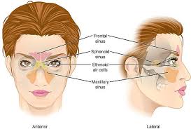Sinuses Are Air Filled Pockets That Create Mucus To Moisturize Our Noses Humidify The Air For Us To Breathe A Sinus Surgery Sinus Headache Sinus Inflammation