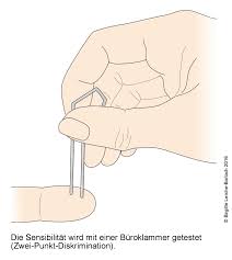 Karpaltunnelsyndrom Wie Lange Krank Handlenpami
