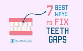 Over time, you may close the space between those teeth. How To Fix Gaps In Teeth These 7 Best Non Painful Ways