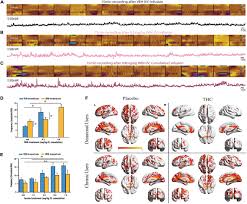 Guess i'm done with concepting, start detailing. Frontiers Cannabinoid Modulation Of Dopamine Release During Motivation Periodic Reinforcement Exploratory Behavior Habit Formation And Attention Frontiers In Synaptic Neuroscience