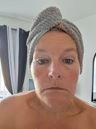 Lupus warrior shares weight loss progress