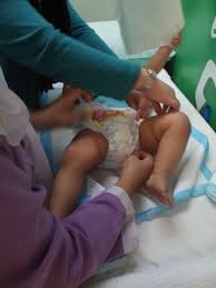 Sunat bayi perempuan memang banyak dilakukan oleh orangtua zaman dulu di indonesia, lho. Norhayati Zambri Terlambat Sunatkan Baby Anis