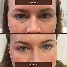 LiveVibrant Wellness & Aesthetics