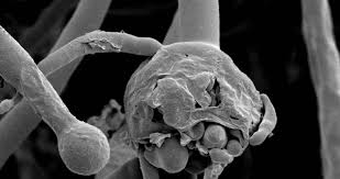 La mucormicosis, comúnmente llamada hongo negro, es una infección muy rara. 6 Preguntas Claves Para Entender El Hongo Negro Que Ataca A Pacientes De Covid 19