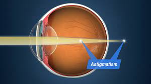 Share a gif and browse these related gif searches. Orthok All Eyecare Optometry