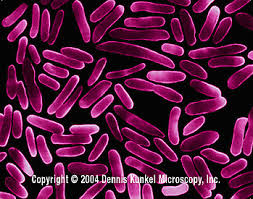 Escherichia Coli