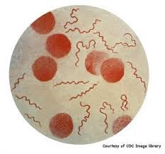 Morgellons disease should be treated as early as possible to improve the ultimate outcome that a patient will achieve. Morgellons Disease Mybiosource Learning Center