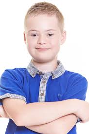 43 Models With Down Syndrome