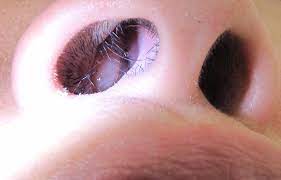 Nasal polyps are polyps in nasal cavity. Nasal Polyp Wikipedia