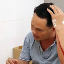 Điều dưỡng bị người nhà bệnh nhân hành hung ngay trong bệnh viện