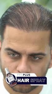 Ultimate Transformation: FEG+ Hairspray for Thicker Hair Growth