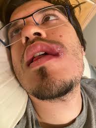 Bitey Face has begun ❤️❤️