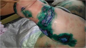 It is often done for aesthetics, sexual enhancement, rites of passage, religious beliefs, to display group membership or affiliation, in remembrance of lived experience. Eap 2019 Congress And Master Course Springerlink