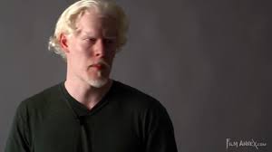 Model (2), albino (2), male model (1) my tags: Stephen Thompson By Modelswebtv Interviews