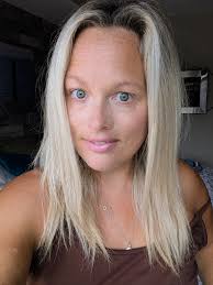 Hi all, hope you're all well. Can you help please? My skin specialist said  this is psoriasis, do any of you have this