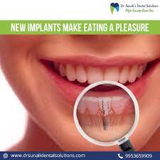 Fill The Gaps In Between Your Teeth And Enjoy Your Favourite Food Like Before Visit Dr Sunali S Dental Solutions To Kn Gum Treatment Cosmetic Dentures Dental
